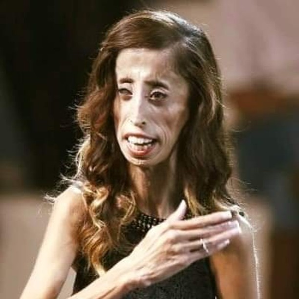 The Power of Kindness: Lizzie Velásquez’s Mission to Change the World